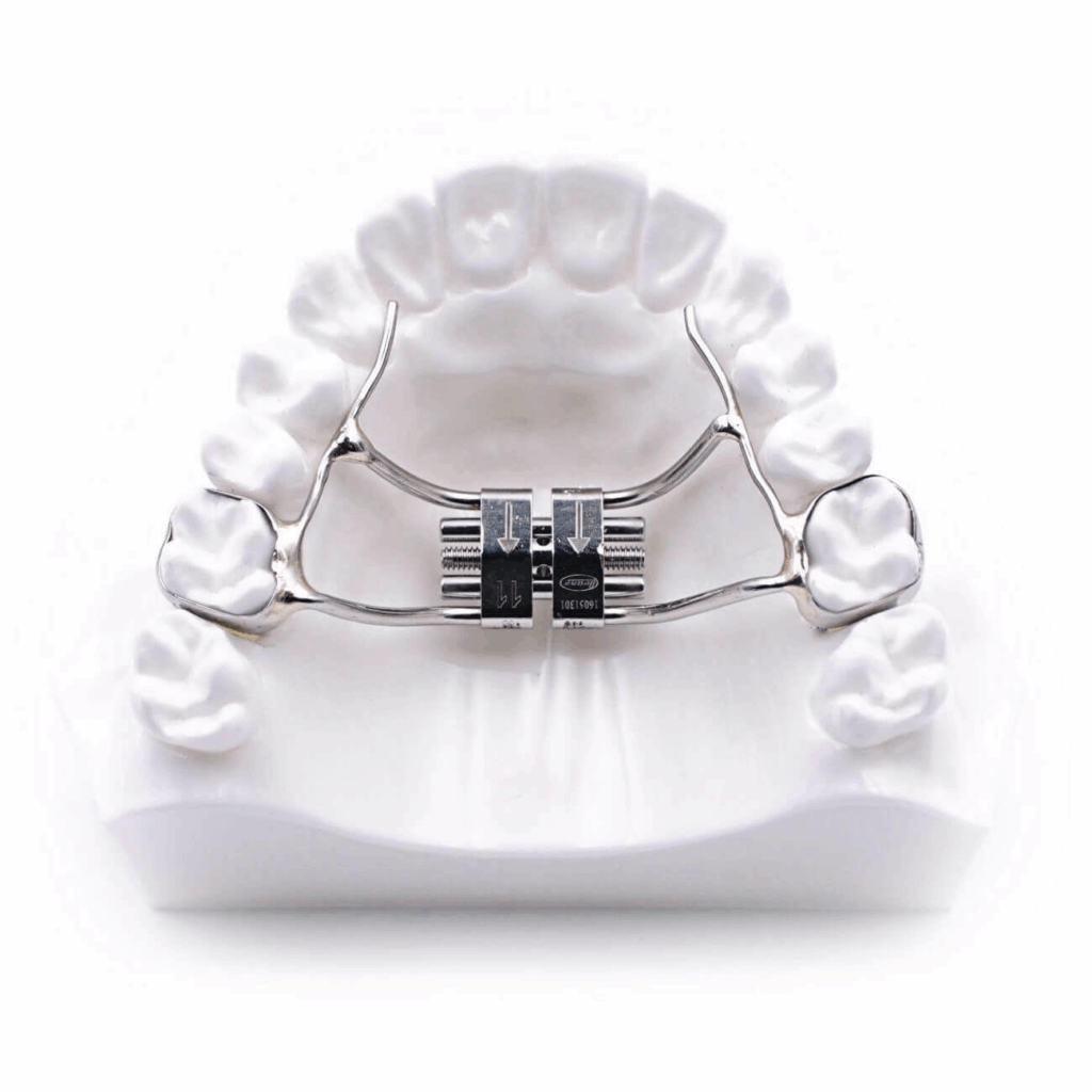Palatal Expanders