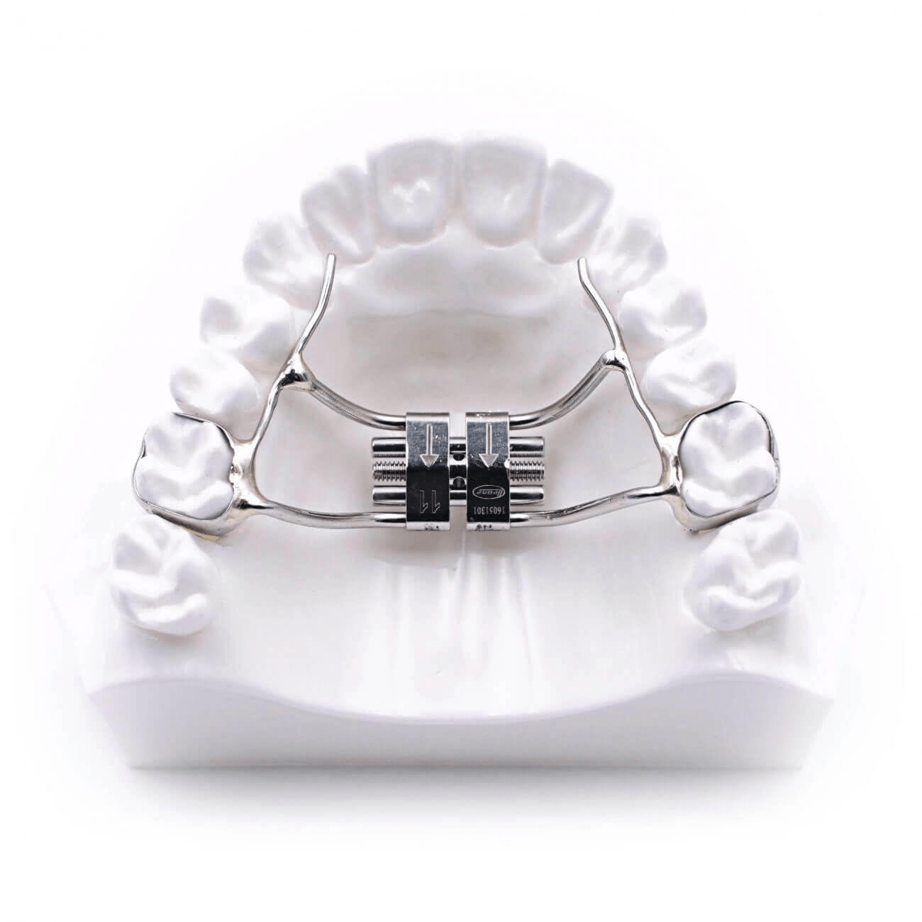 Palatal Expanders